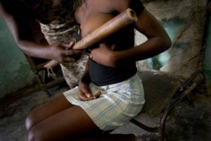 Breast ironing with spade in Douala Cameroon.