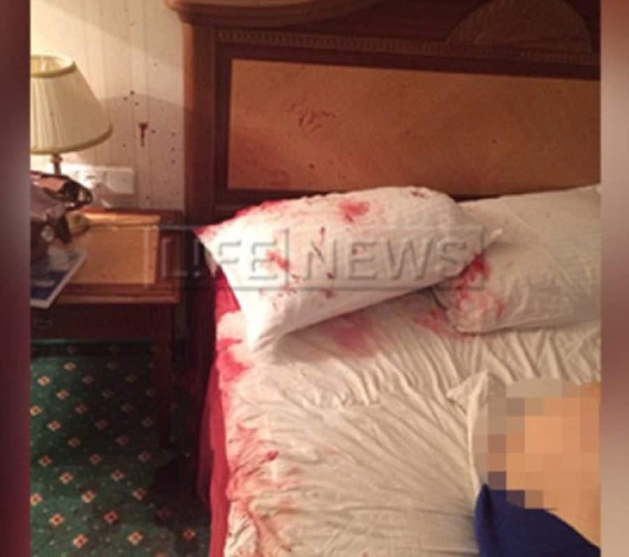 The hotel room bed spattered with blood